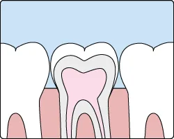 Dental sealants